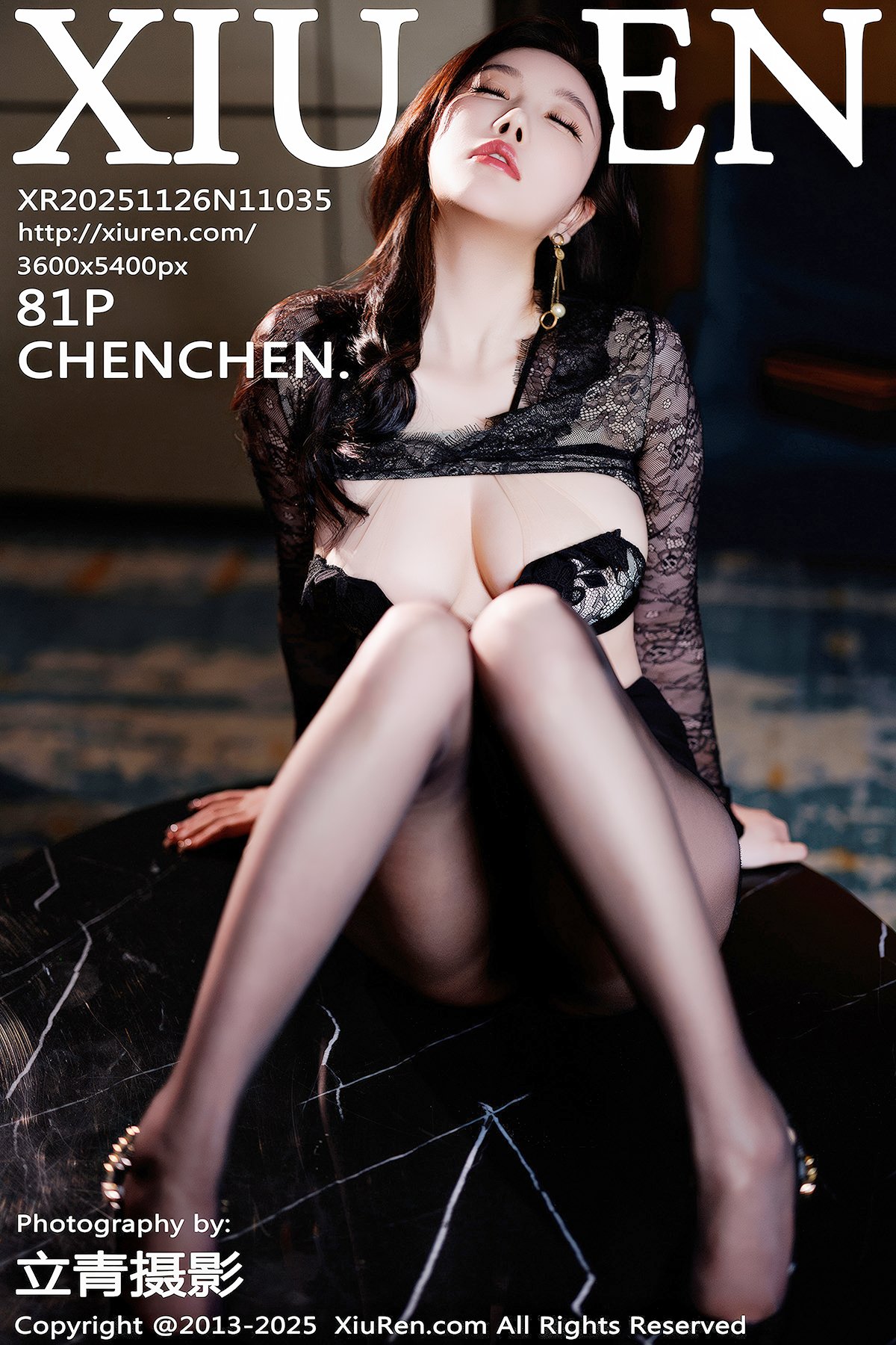 XiuRen秀人网 No.11035 CHENCHEN (82P)